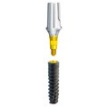 Implants étroits BioniQ S2.9